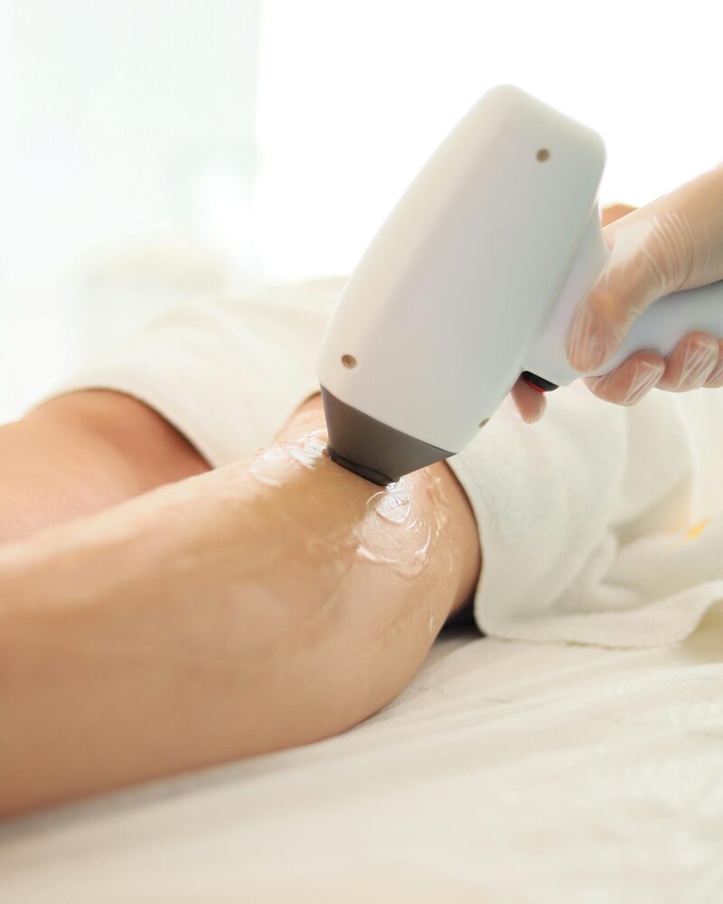 Laser hair reduction treatment