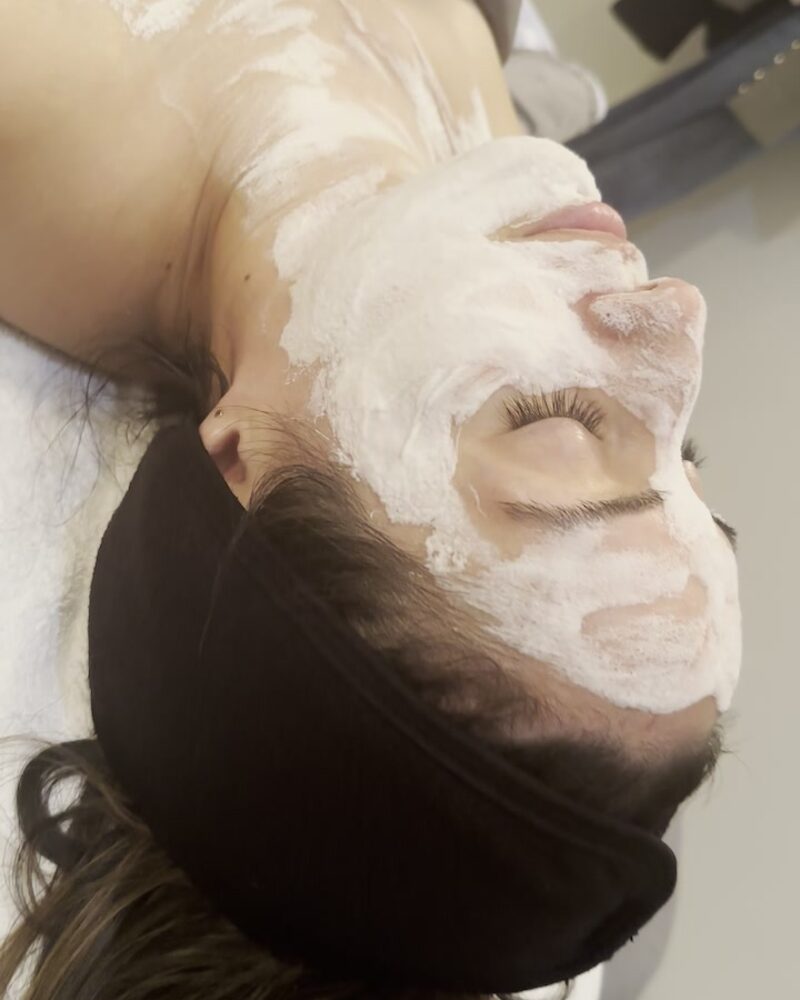 Microneedling treatment being performed at Rocky Mountain Skin in South Salt Lake, Utah