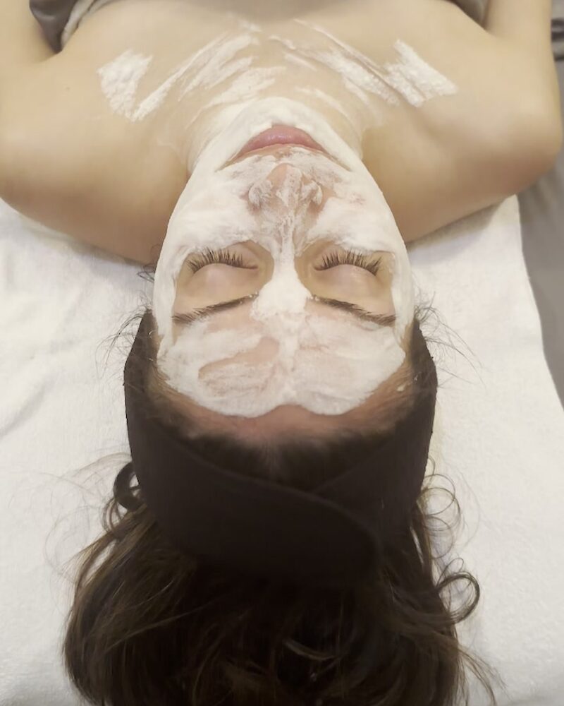 Microneedling skin treatment